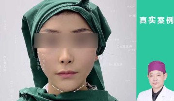 魔法筋膜折叠术后即刻